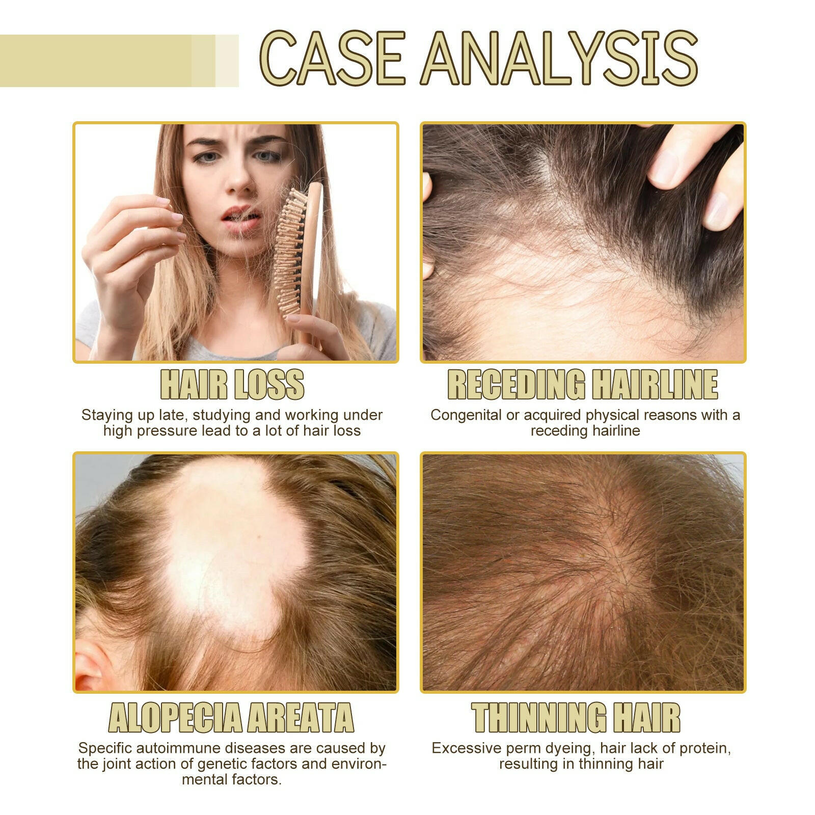 Rosemary Hair Essential Oil – Repair, Anti-Hair Loss & Softening - Adistore