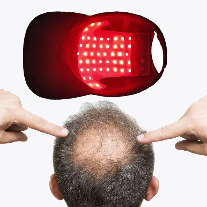 Wireless Easy-to-Use Hair Loss Treatment Cap - LED red light therapy for hair regrowth.